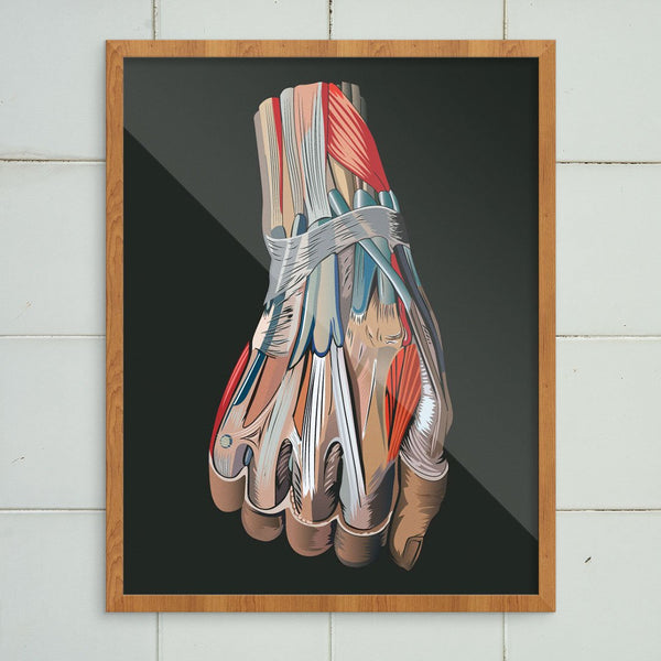 Hand Medical Diagram Print